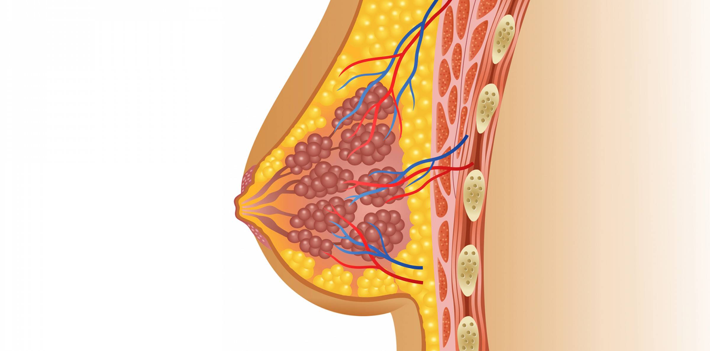 Новообразование в груди у женщин. Злокачественное новообразование молочной железы. Кровоточащая молочная железа. Злокачественные новообразования грудных желез у женщин. Молочная железа у женщин.